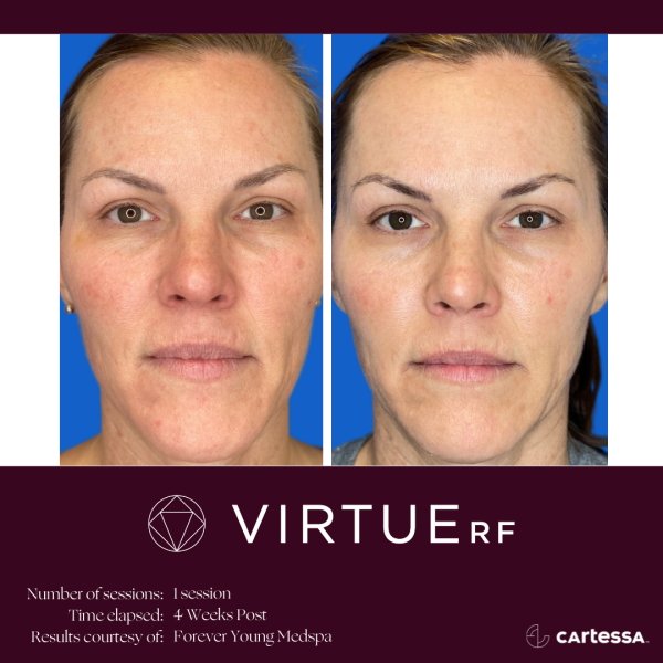 VirtueRFBAFemaleFaceTexture2.jpg