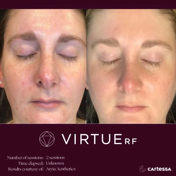 VirtueRFBAFemaleFaceTexture5 (1).jpg