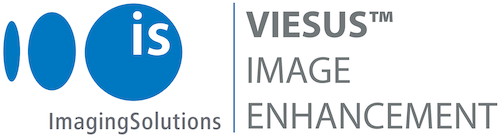 ImagingSolutions_VIESUS_Image_Enhancement_sm.png