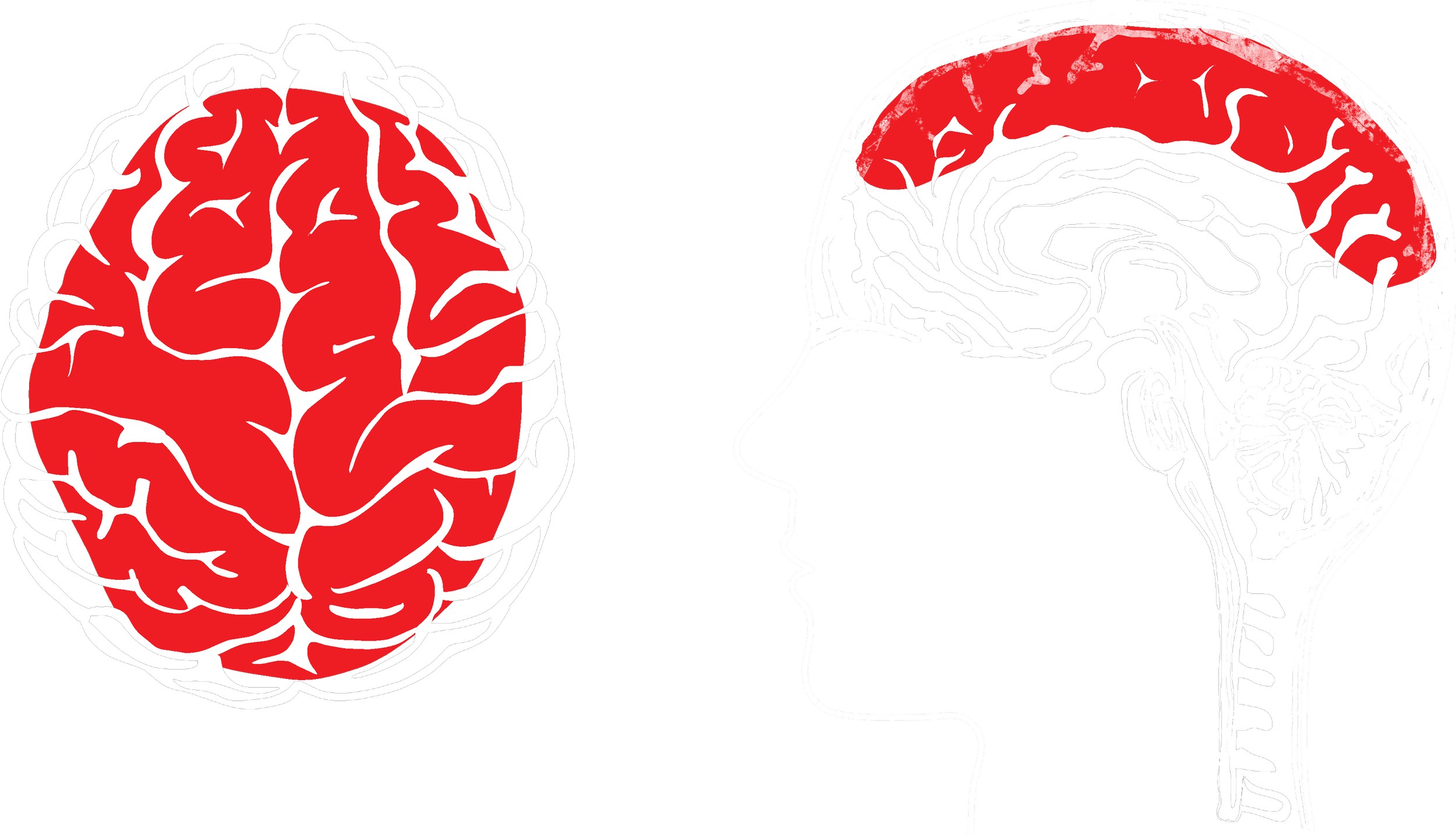 Memory Channel imPRINTING the neocortex