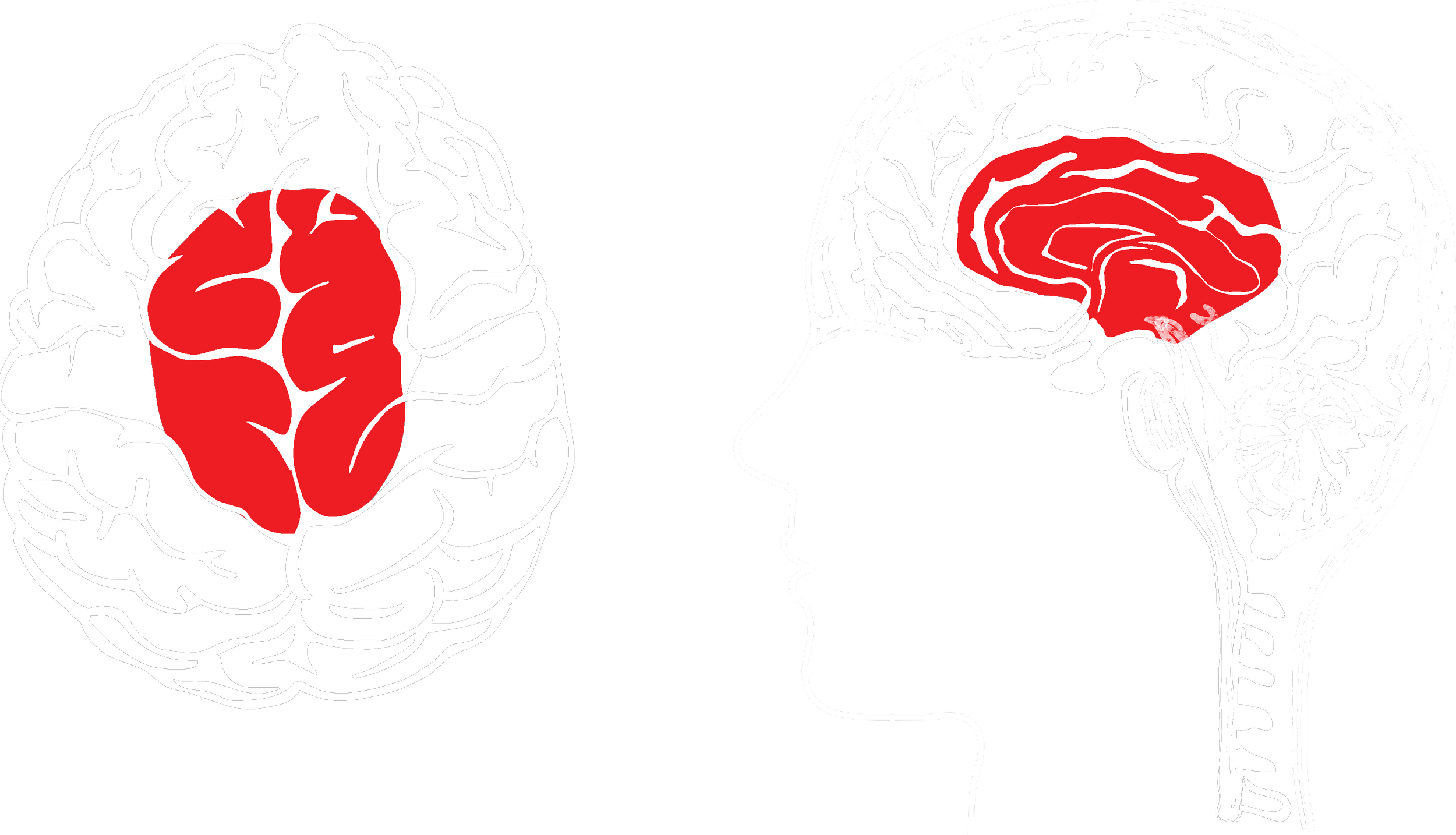 Music [Forward] imPRINTING the limbic system
