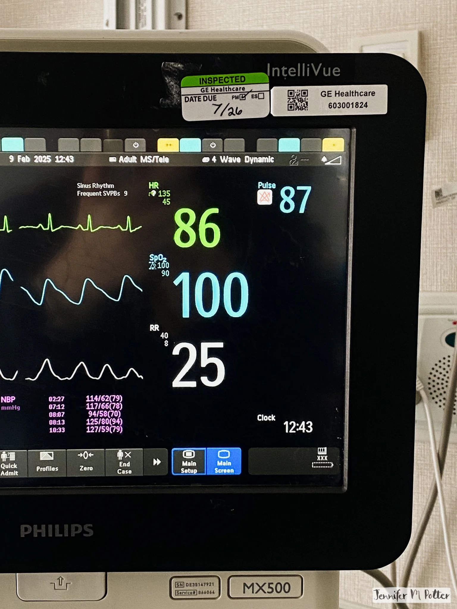 A shot of the patient monitor in my Dad's hospital room. The O2 level is not so good despite him being on 100% oxygen.