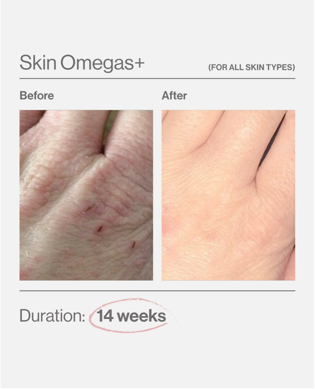 Skin Omegas+ 5.png