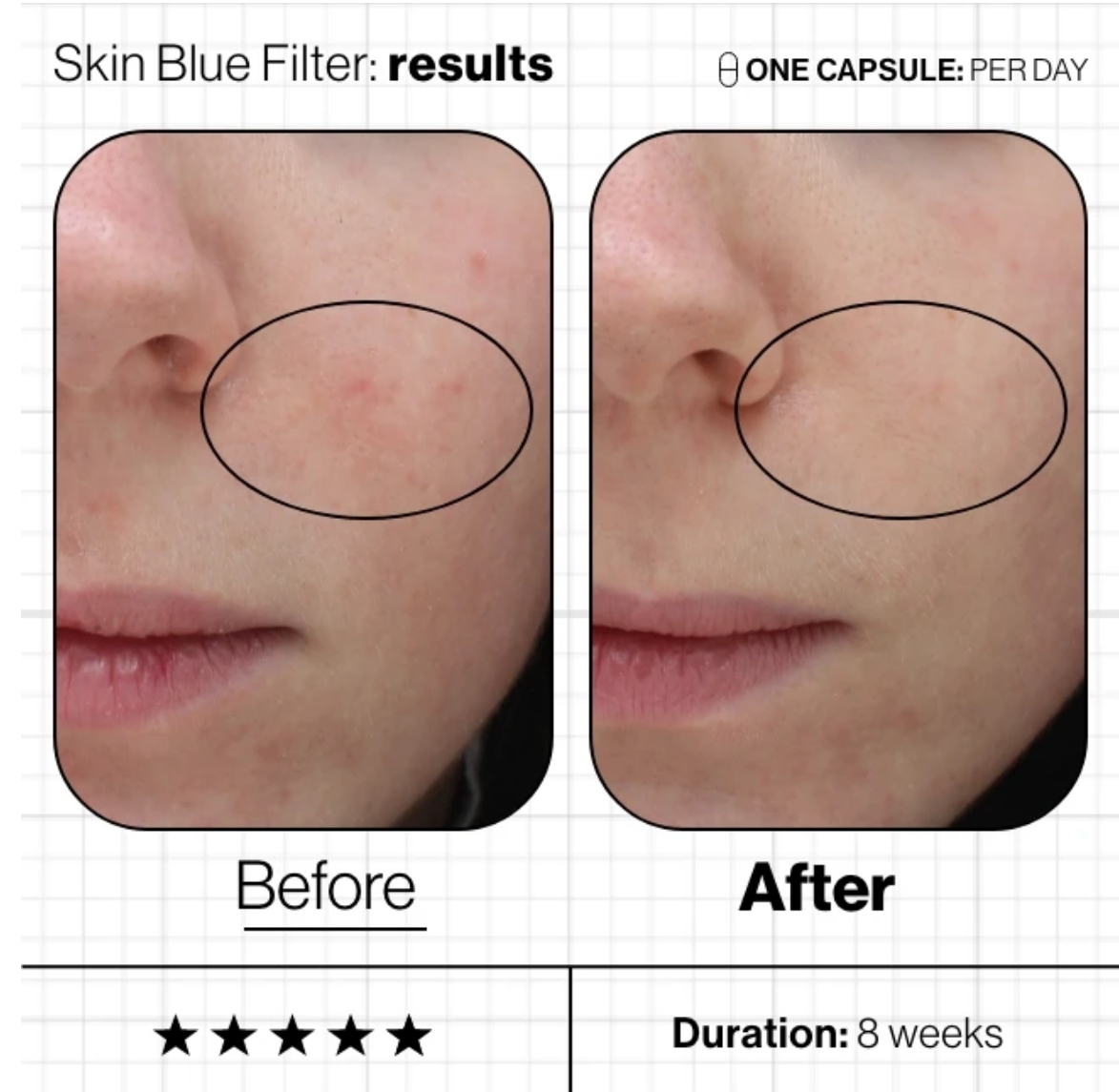 Skin Blue Filter 5.png