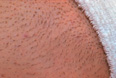 Bikini Line Before