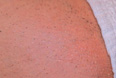 Bikini Line After