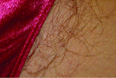 Bikini Line Before