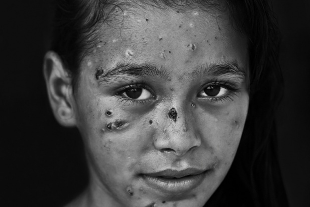 Dalia's photo taken at the hospital. 1st August 2014