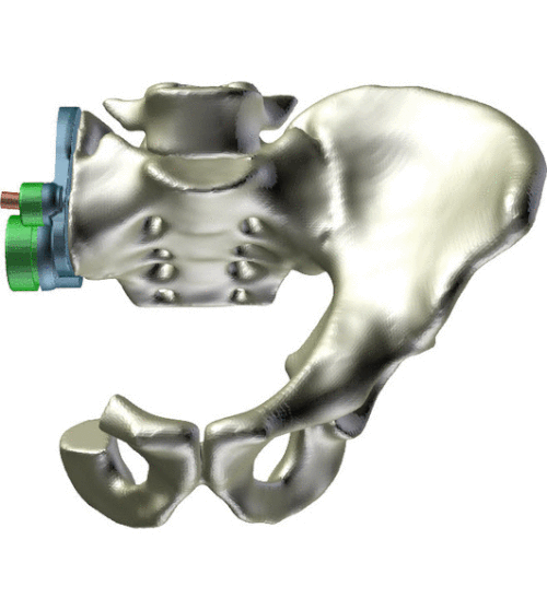Variable Tilt & Translation Device