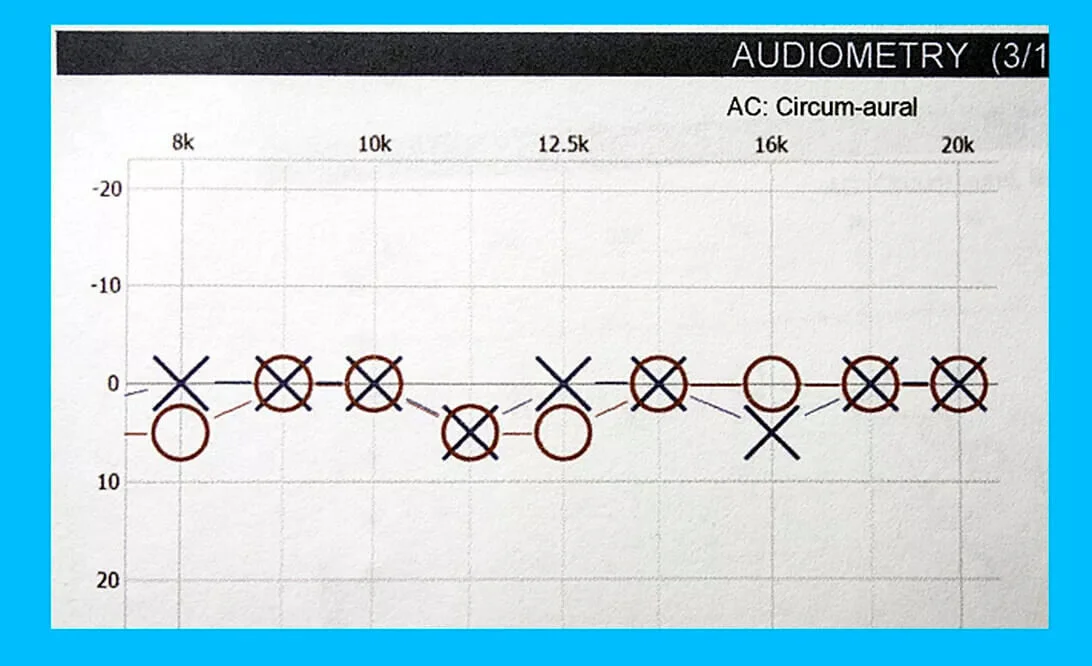 What to Expect at a Hearing Test — Musicians Hearing Solutions