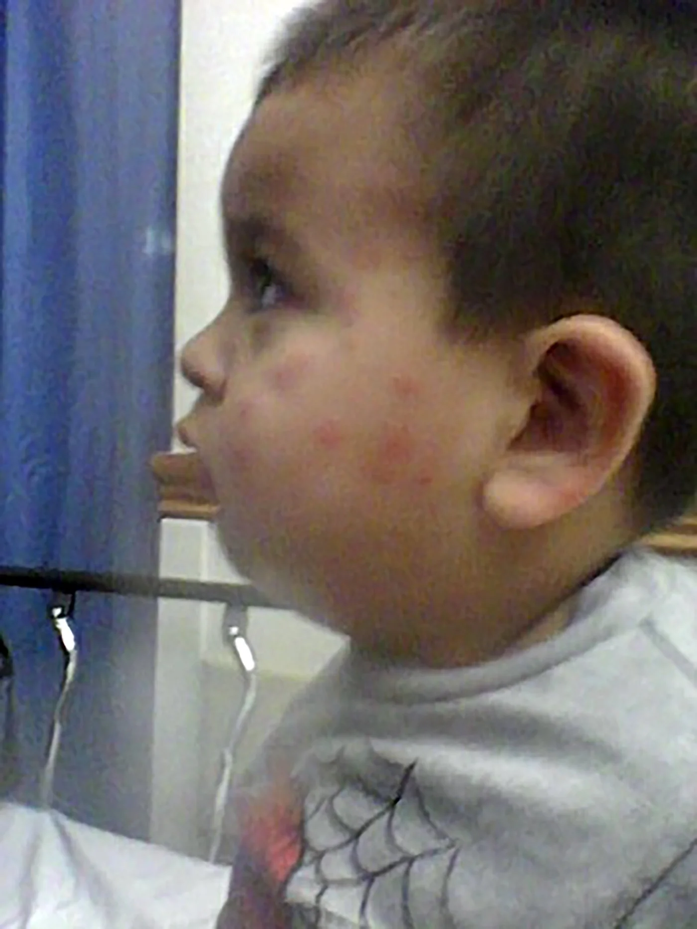 Jorge Maravilla’s body was covered in bug bites as his parents battled an infestation that lasted for months. A civil jury awarded his family $1.6 million on Monday. Credit via Brian Virag