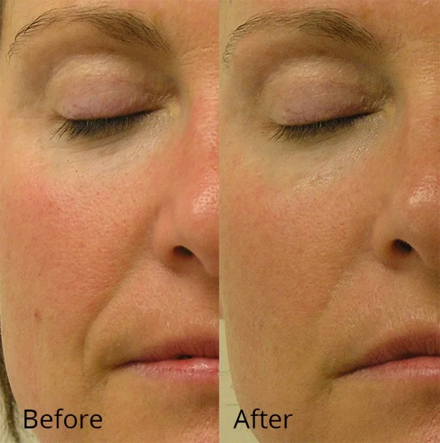 2hydrafacial.jpg