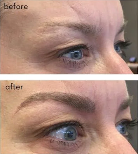 brows-before-after.jpg