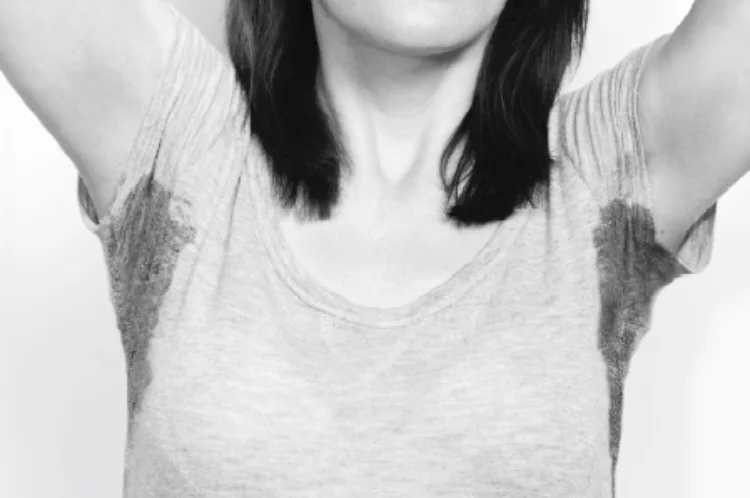 underarm sweating botox lancashire.jpg