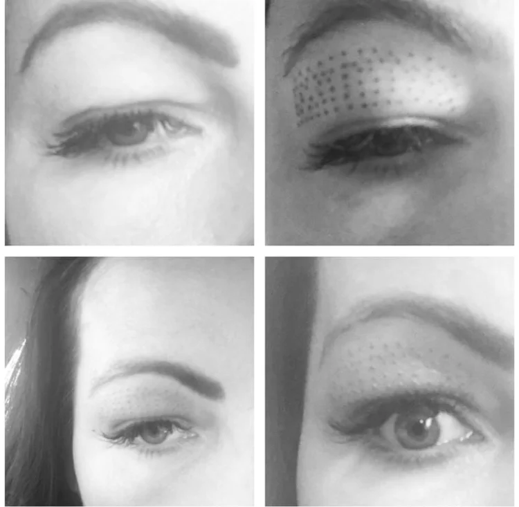 JP Plasma BT eye.jpg