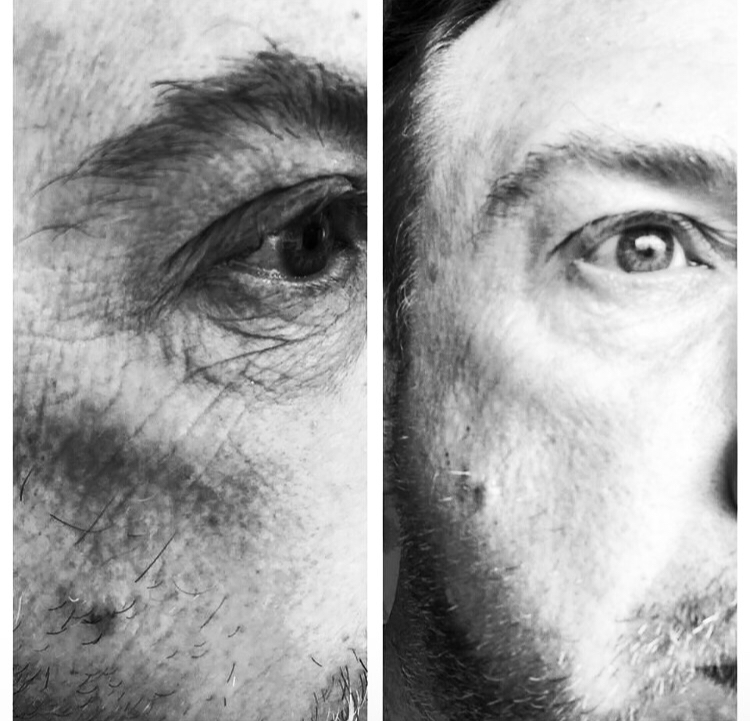 Plasma BT mans eye.jpg