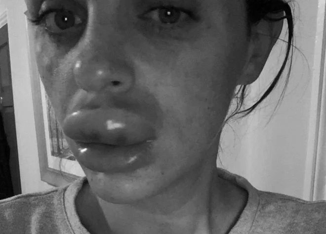 big lips.jpg