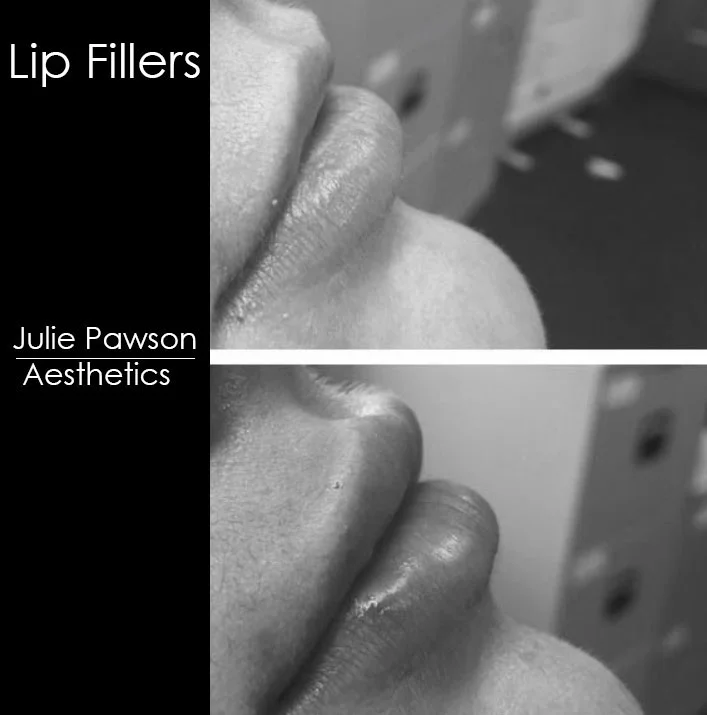 lips 1.jpg