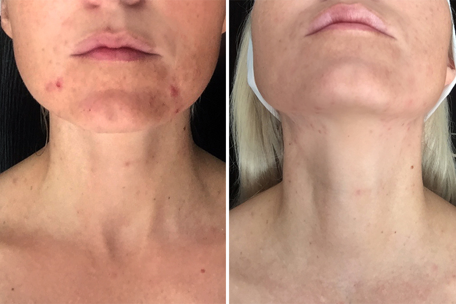 Before 3 Weeks After