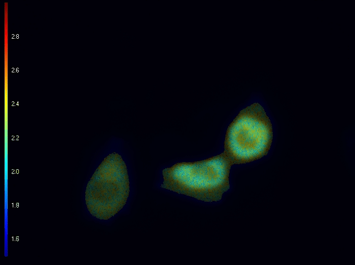 Time-lapse of EPAC sensor courtesy of Netherlands Cancer Institute