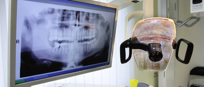 Are X-Rays Safe.jpg