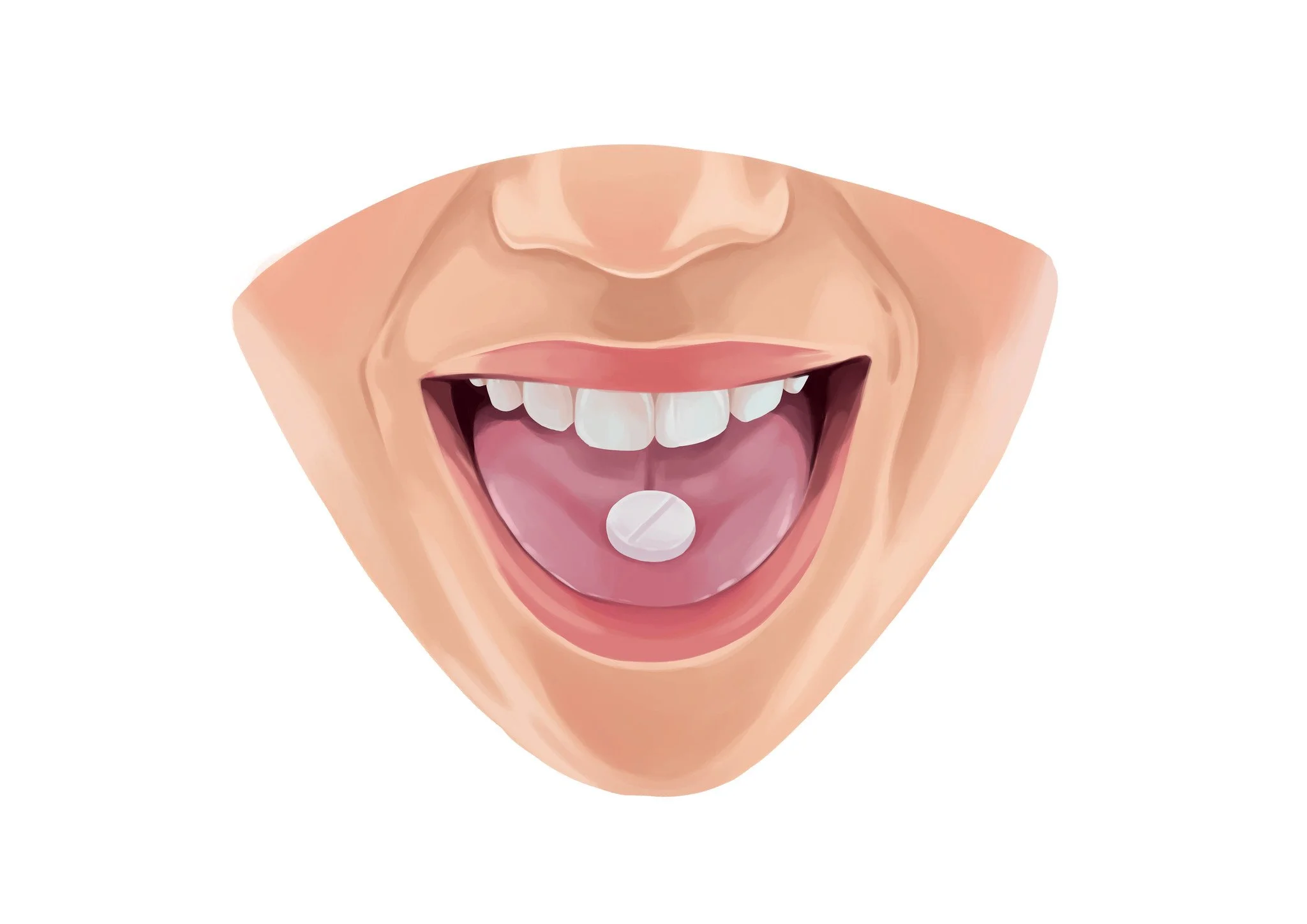 Sedation Dentistry in Chico: Who It Helps and What to Expect Before Your Visit