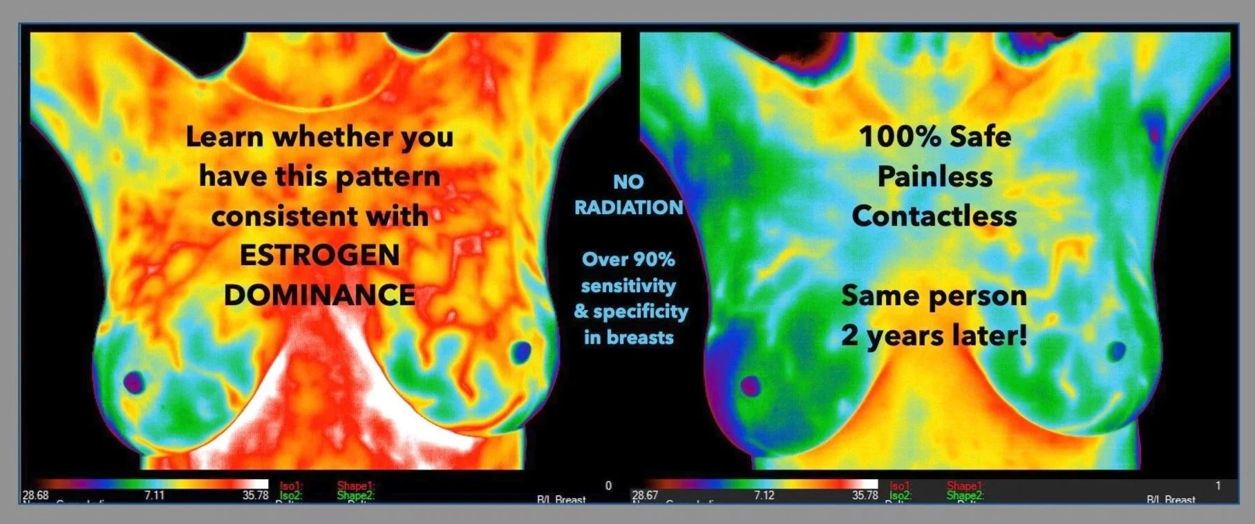 RADIANT BODY THERMOGRAPHY