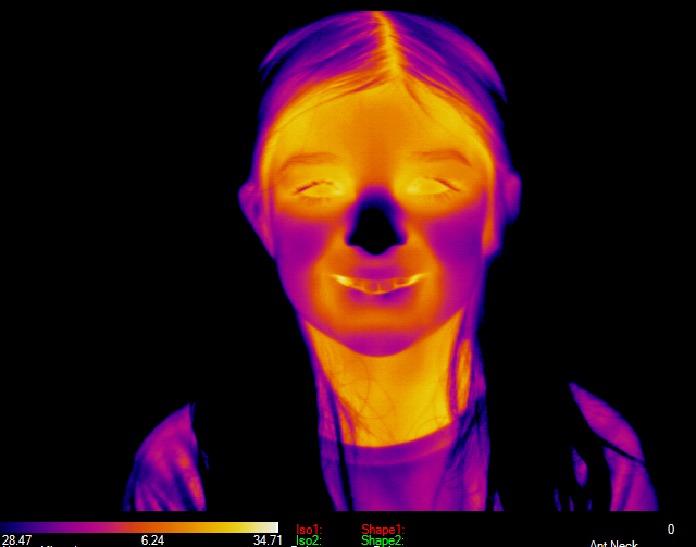 San Antonio TX: Get Imaged Near Boerne! Clinical Thermography on South Fork!