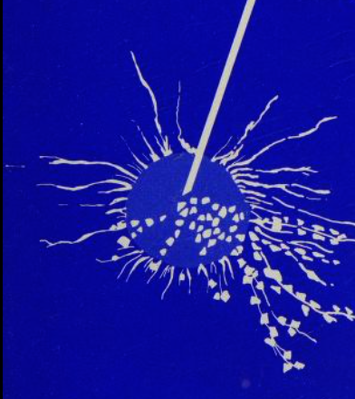 More Evidence That "Stab &amp; Grab" Types of Biopsies Spread Cancer - Defining Tumor "Budding"