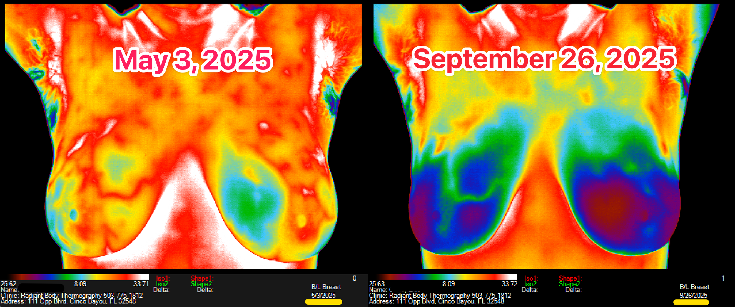 CleanShot 2026-01-03 at 13.43.36@2x.png