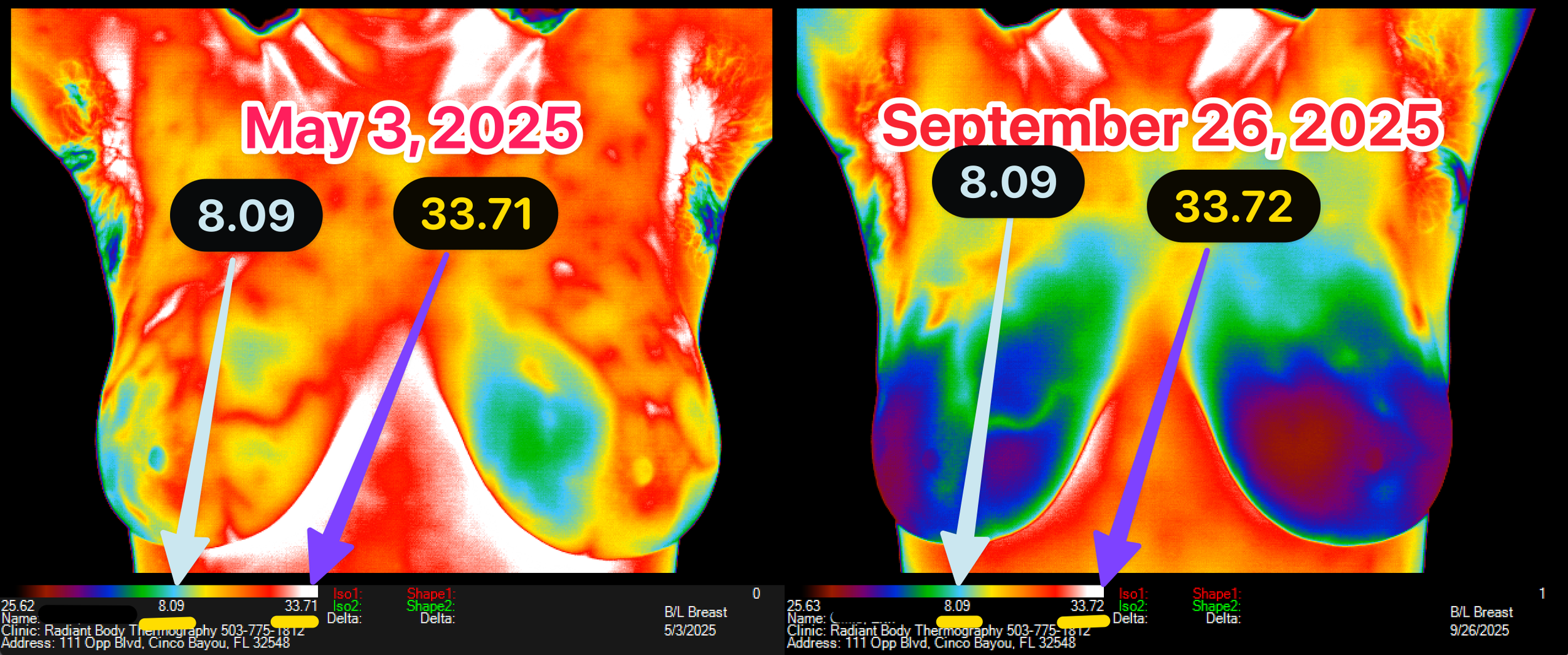 Thermal Images Used To Sell Products, Pills, Potions, &amp; Lotions - Which Images Can Be Believed &amp; Which Are Potential Red Flags 🚩 Scam Alert🚨 Do Not Get Sucked In 