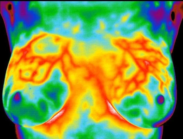 RADIANT BODY THERMOGRAPHY