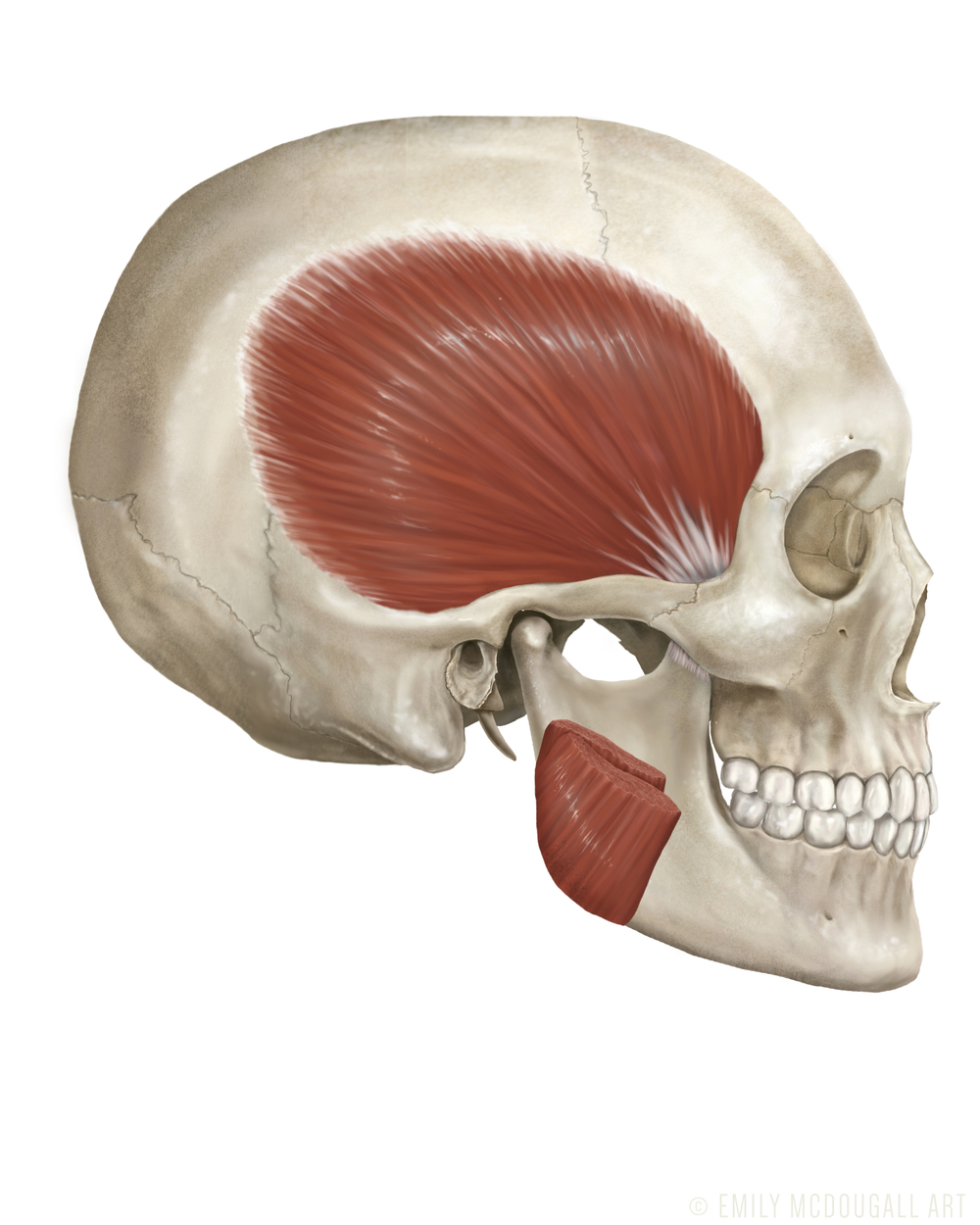 Cut_Masseter copy.jpg