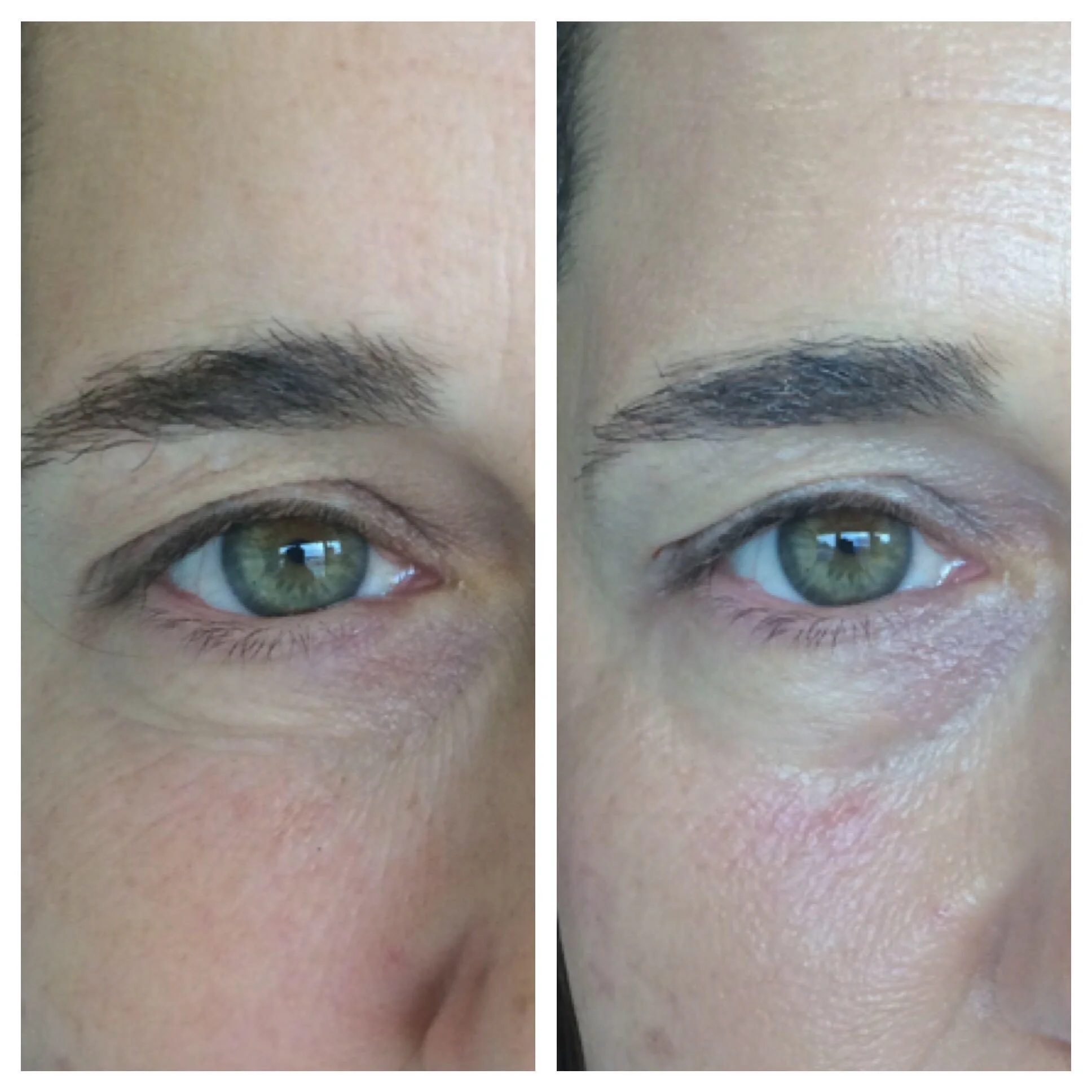 Before & After