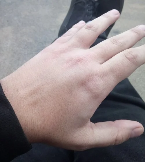 "Why do you hurt, hand? I though we were friends." 