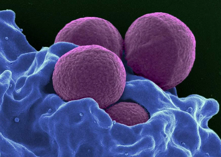 MRSA.jpg