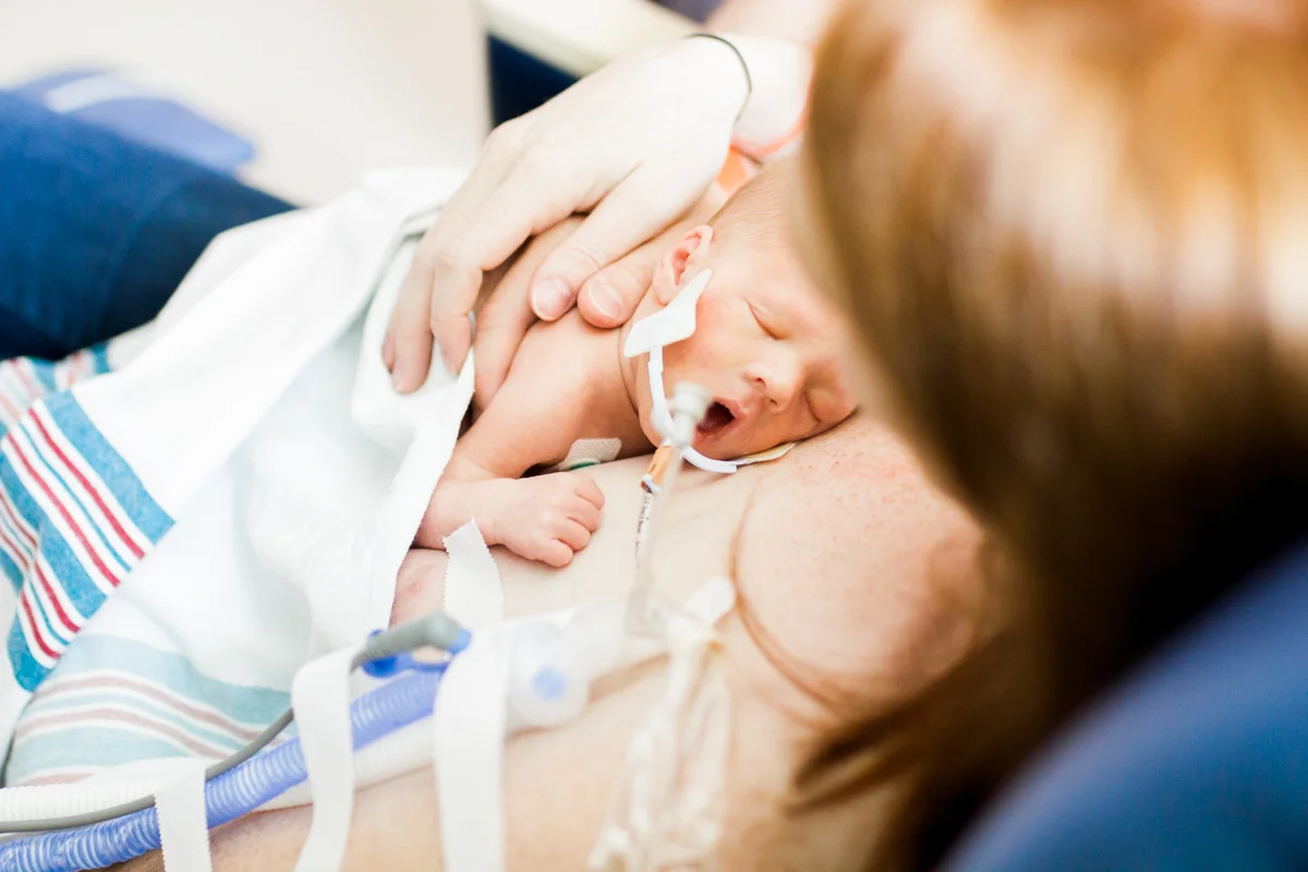 Rebecca Clair Photography lifestyle NICU newborn photography Children's Mercy Hospital mother doing skin to skin with her baby