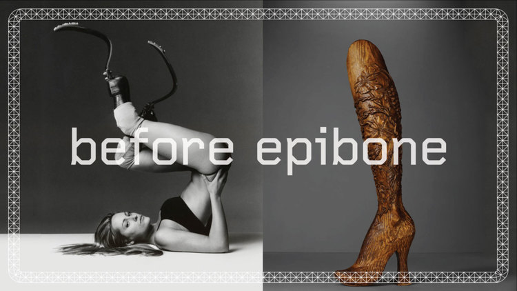  ©Epibone