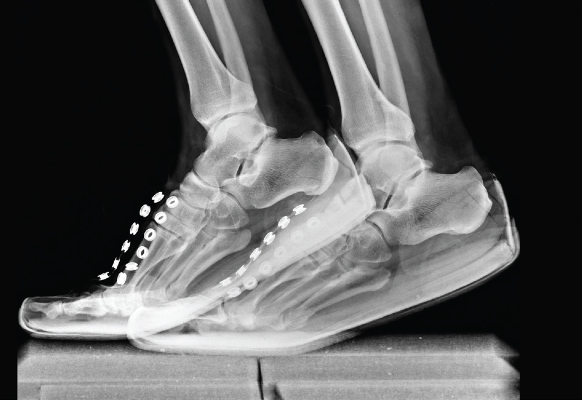 Radiography/Radiographie by Dr. Remy Lehnisch