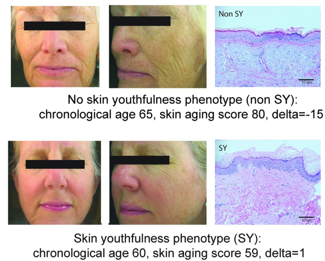 Skin Youthfulness