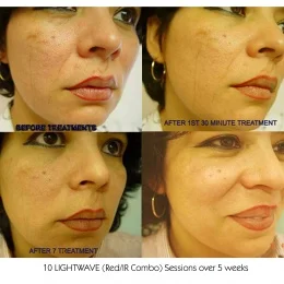 PRINT_Scar_Face_001-260x260.jpg