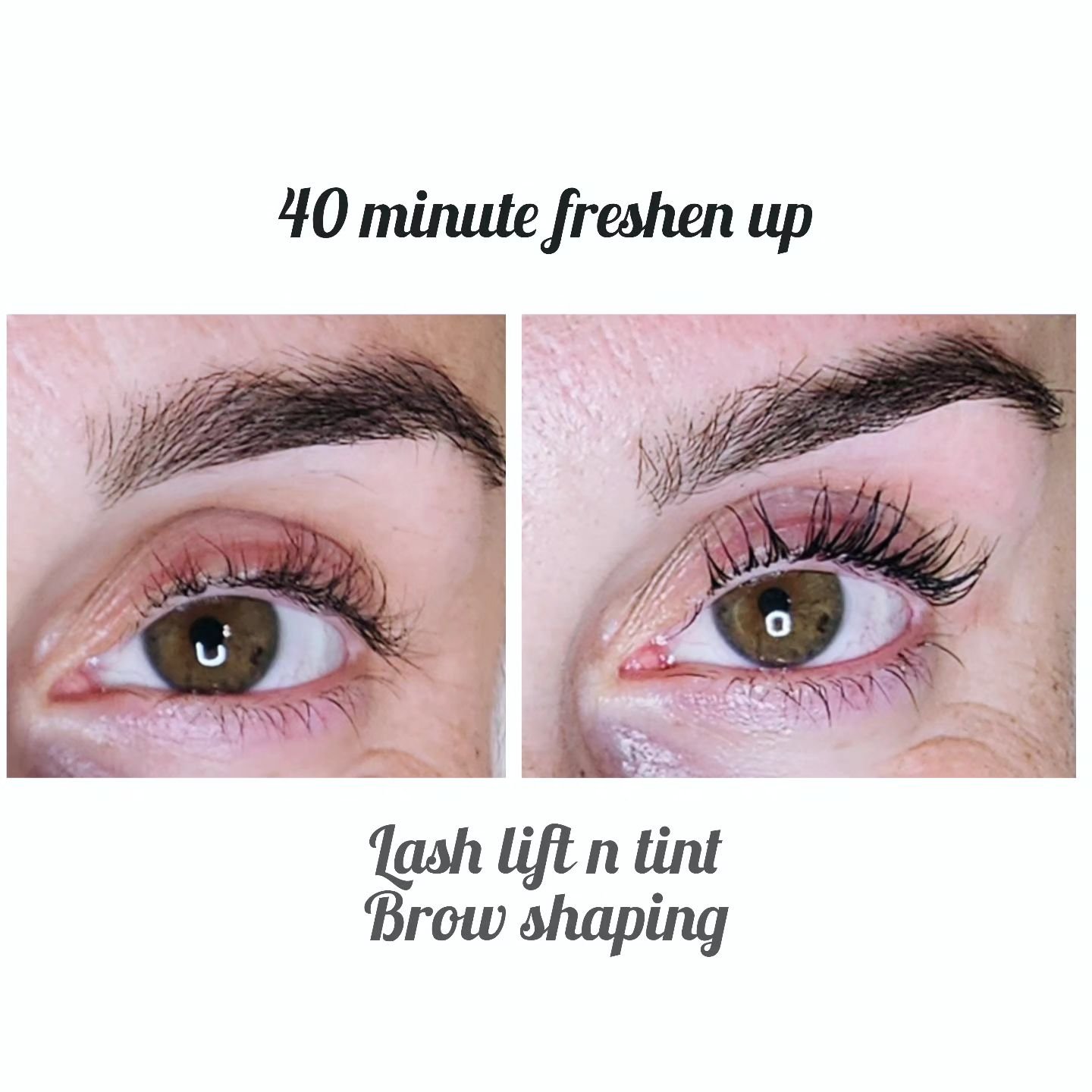 40 min eye lift...🤗 schedule now. Pain free no down time 🥳