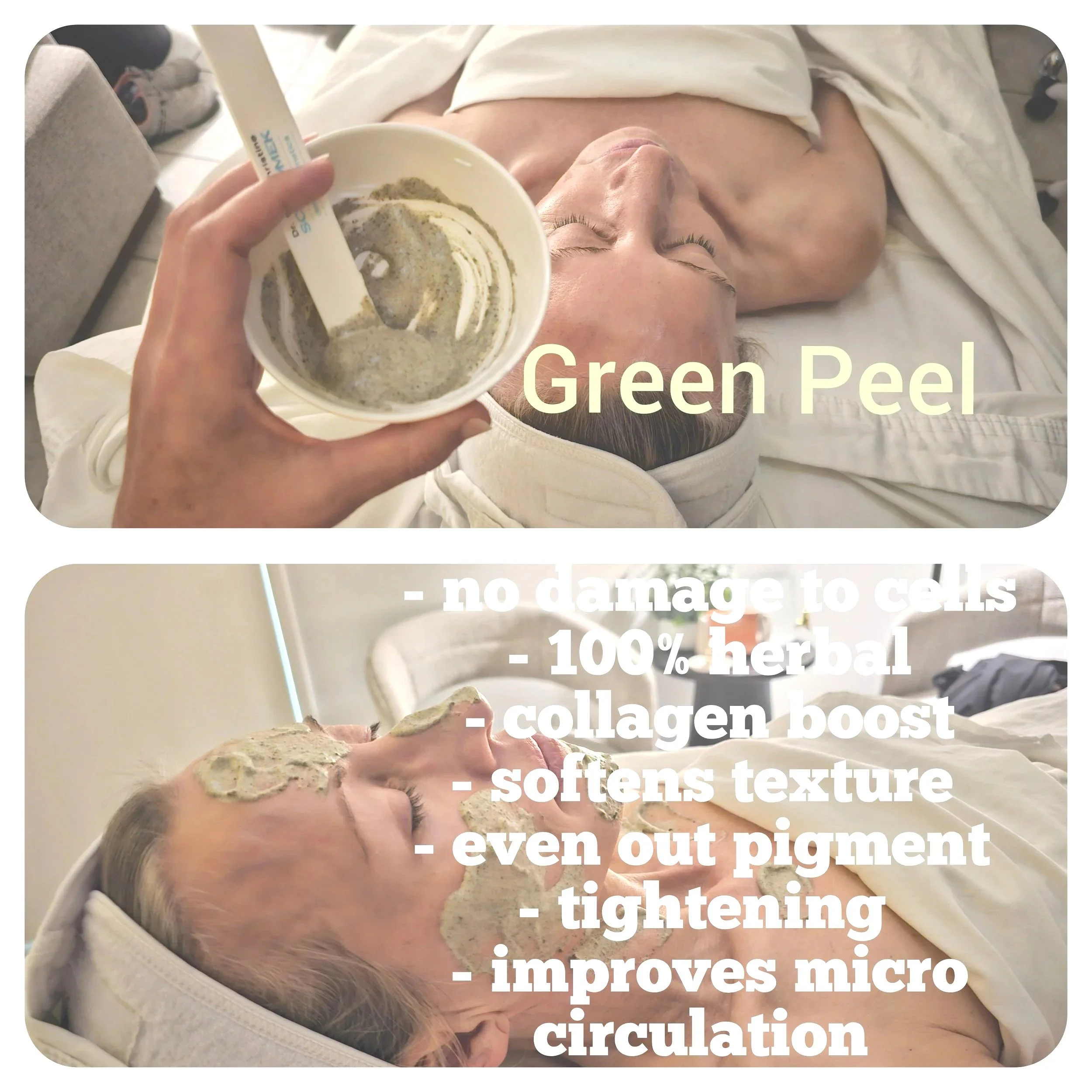 Green Peel Ad No Damage to cells, 100% Herbal Formula, Softens Texture, Evens Out Skin Tone, Tightens Skin, Improves Micro Circulation