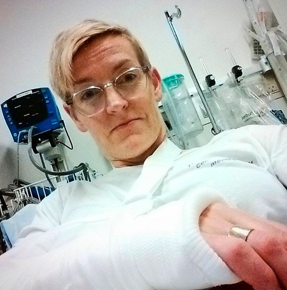 About 4 hours after the accident. Still pretty positive - enough to think that I should take a photo of it all. Wedding ring was some serious work to get off, but off it did come, thanks to a persistent nurse