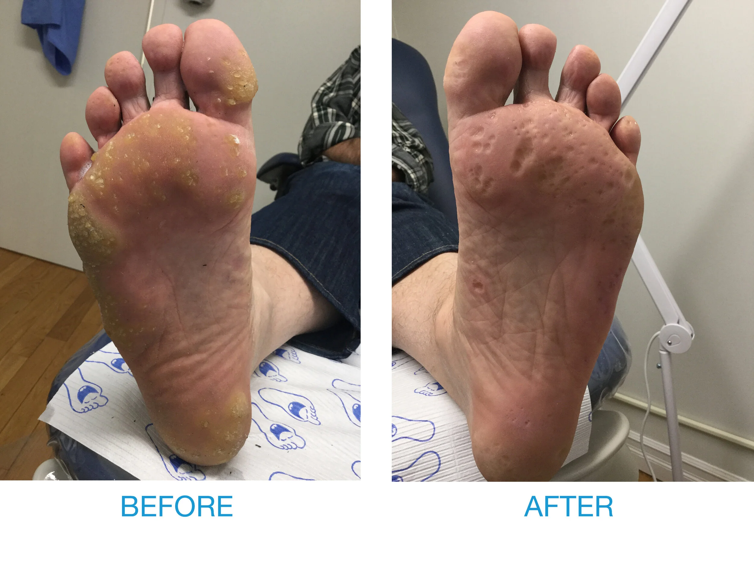 BEFORE & AFTER — Medi Pedi NYC Inc.