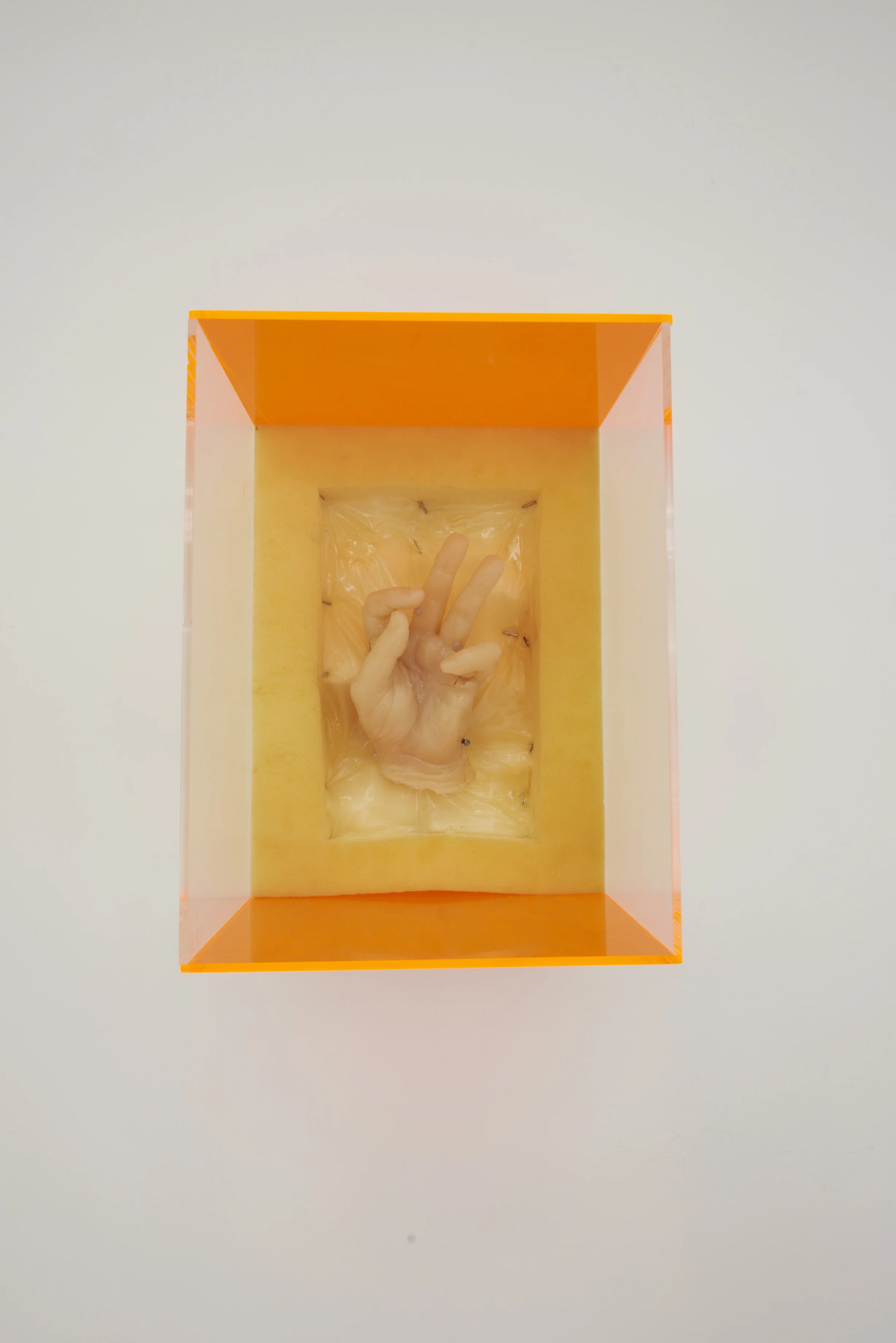 Whitney Vangrin Dupuytren’s Contracture , 2013 DragonSkin silicone rubber, Encapso K, upholstery foam, Plexiglas 16 x 12 x 12 in