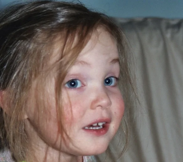 Why I'm not afraid of measles