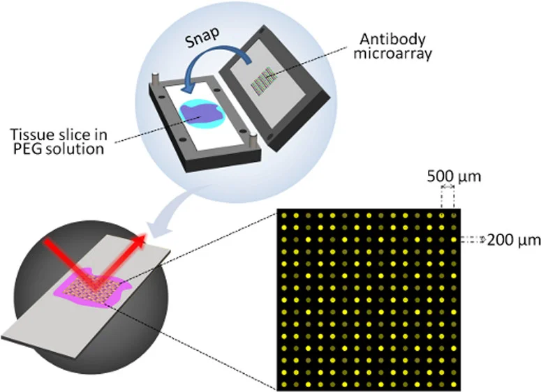  67.&nbsp; H.&nbsp;Li,&nbsp;G.&nbsp;Brewer,&nbsp;G.&nbsp;Ongo,&nbsp;F.&nbsp;Normandeau,&nbsp;A.&nbsp;Omeroglu, and D. Juncker,&nbsp; Immunohistochemistry Microarrays , Analytical Chemistry, 89, 8620-8625 (2017).    PDF    |    SI   