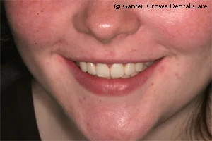 ortho1_patienta_after.jpg