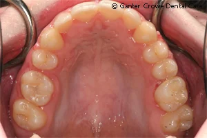 ortho5_patiente_after.jpg